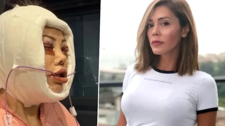 Gözyaşları İçinde Gelen Acı İtiraf Herkesi Şoke Etti