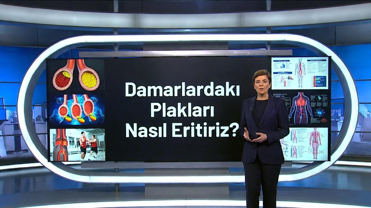 Atardamar Plakları Nasıl Eritiliyor?