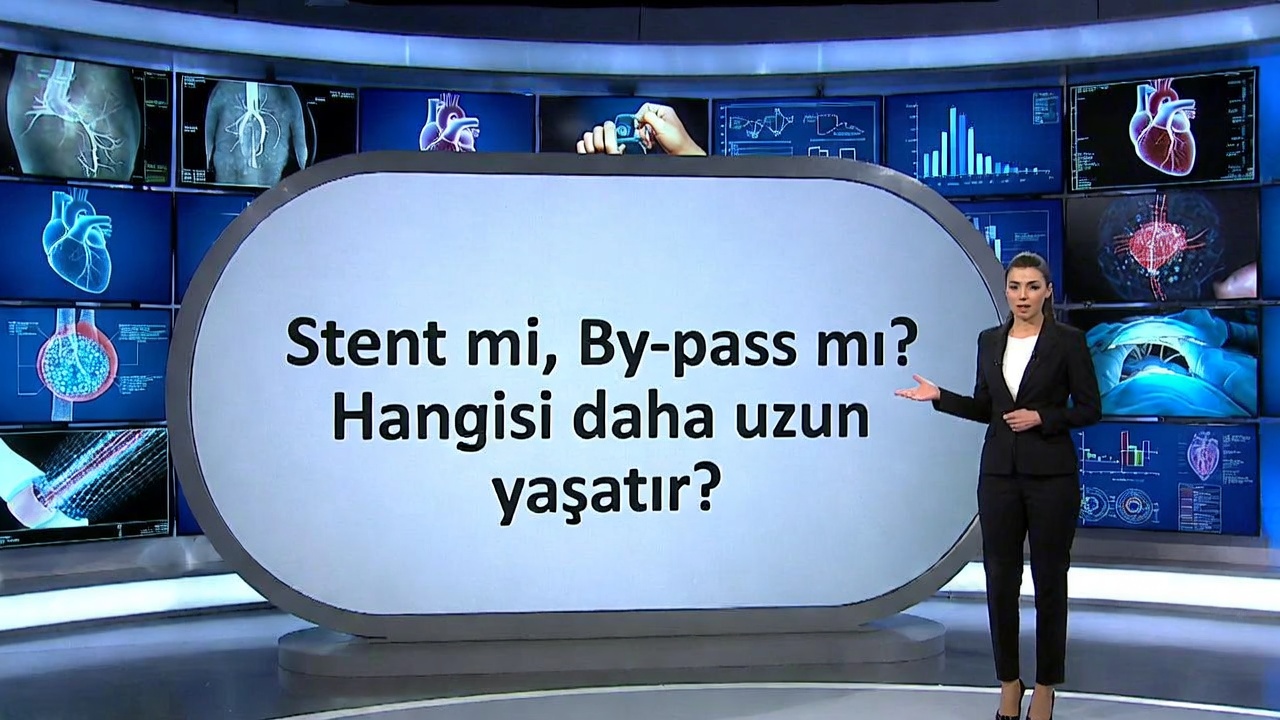 Stent mi Bypass mı? Hangisi Daha Uzun Yaşatır?